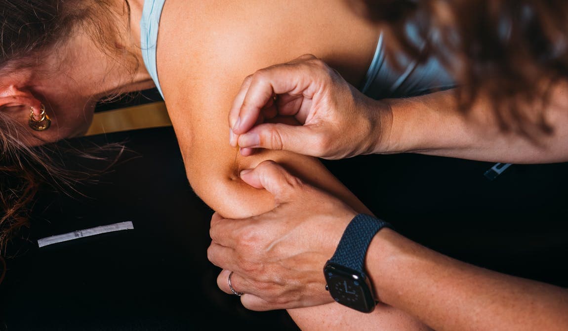 Patientin bei PhysioSport Köln, Physiotherapeutin bestimmt Einstichpunkte im oberen Rücken für Behandlung mit Dry Needling.